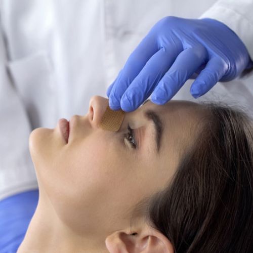 Rhinoplasty – A Facial Feature Designed for You
